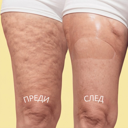 Повдигаща Лента за Крака, Ръце и Корем