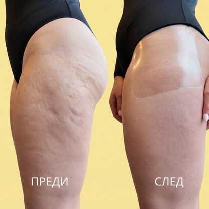 Повдигаща Лента за Крака, Ръце и Корем